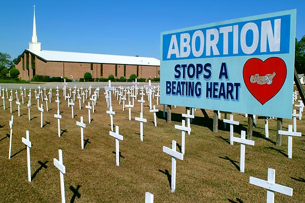 Абортът спира биещо сърце