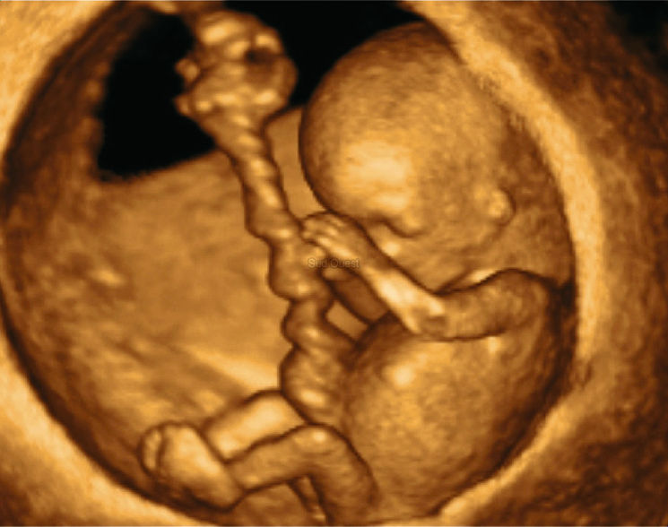 Бебе в утробата - 3D ехограф