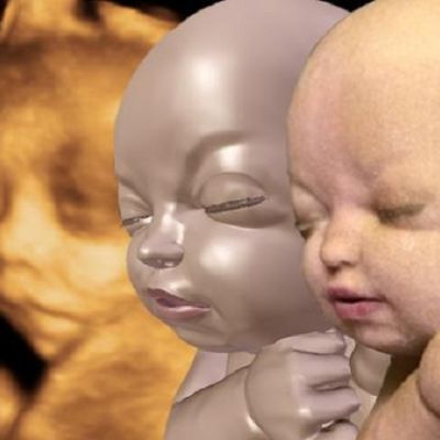 3D модел на фетус - неродено бебе