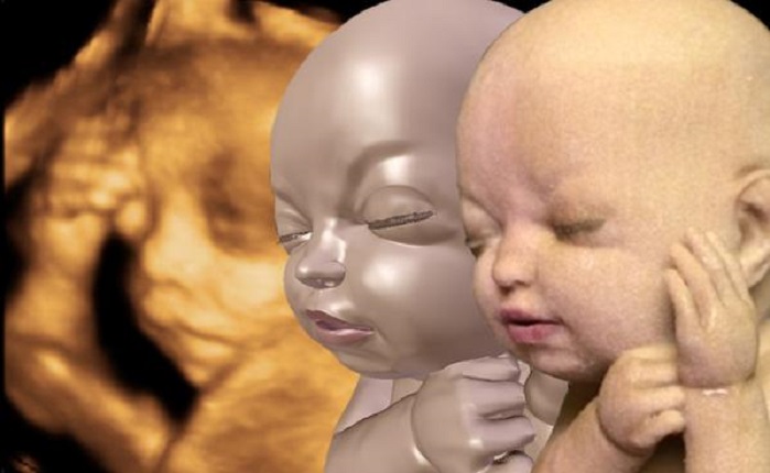 3D модел на фетус - неродено бебе