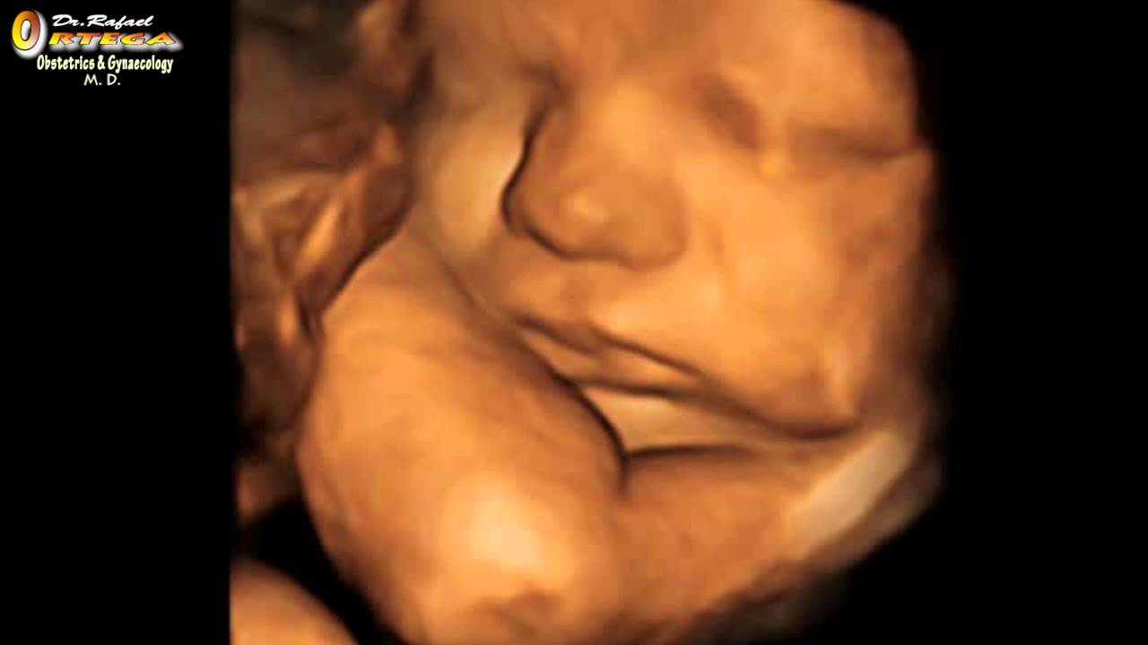 Неродено бебе, ултразвук, видеозон
